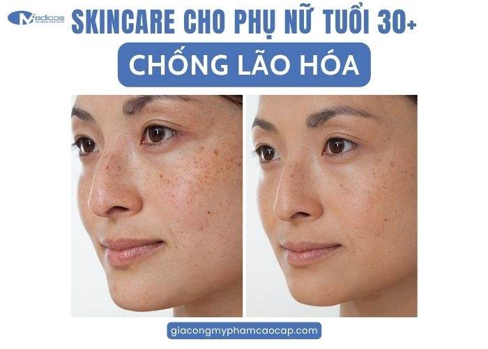 Skincare cho phụ nữ tuổi 30+